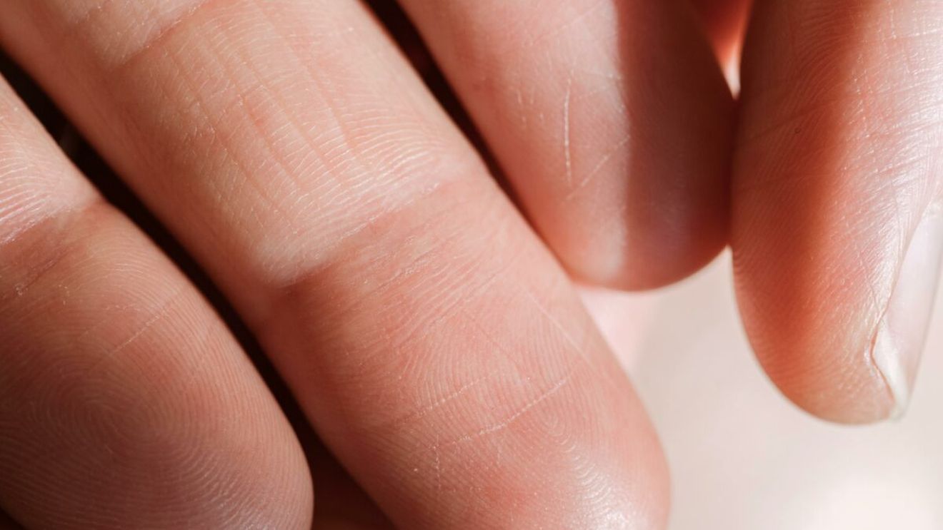 Știați că gemenii identici nu au aceleași amprente? Află aici cauzele