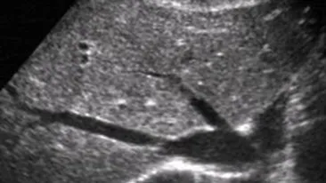 Medicii au ramas socati dupa ce au descoperit ce se afla in burta acestei femei: Nimeni nu-i dadea nicio sansa