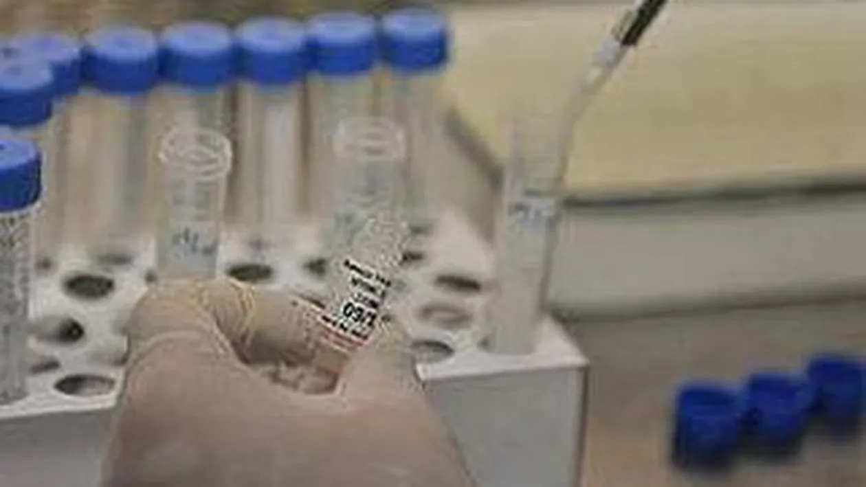 Atentie! Medicii nu recomanda testele rapide de depistare a gripei