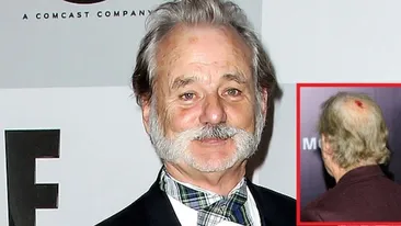 HORROR! Un actor urias de la Hollywood a venit pe covorul rosu cu capul spart