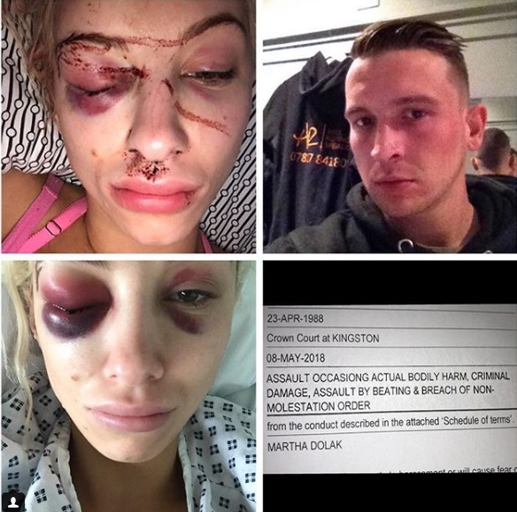 O vedetă bătută și sechestrată de iubit s-a salvat după ce a trimis un selfie cu fața tumefiată
