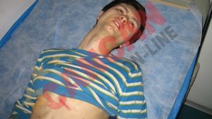 "M-au crestat pe tot corpul!"