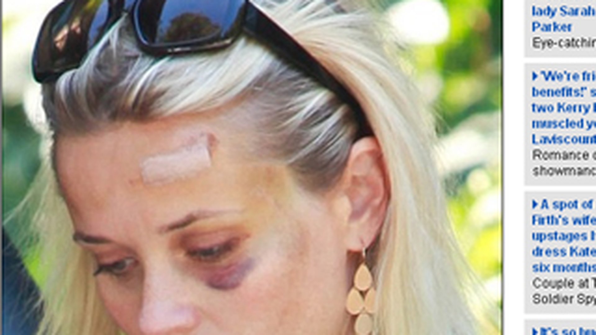 Uite cum arata Reese Witherspoon dupa ce a fost lovita de masina!