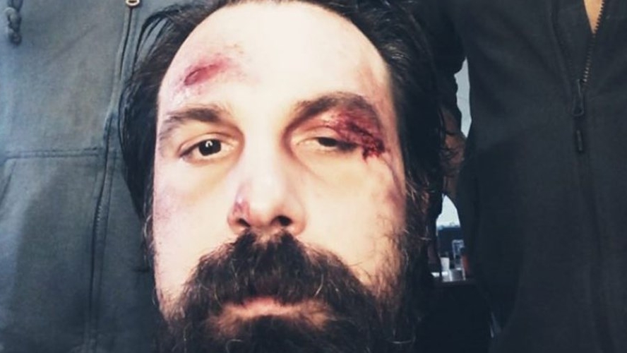 Alex Papadopol, desfigurat în bătaie după ce a fost prins la nudiști. Doar în filme vezi așa ceva!