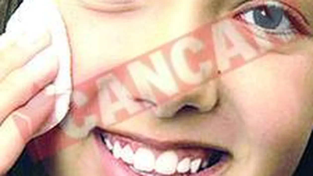 Metode de prevenire a acneei