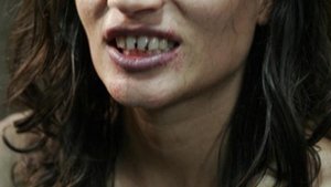 Ce ti s-a intamplat, Ioana Ginghina? Arati precum o victima de-a lui Dracula!