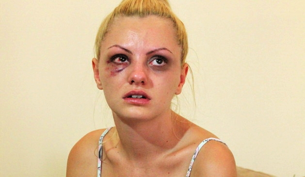 Alexandra Stan după bătaia încasată de la Marcel Prodan