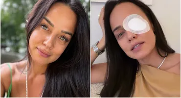 Andreea Raicu a apărut cu un ochi bandajat! Ce a pățit vedeta: „E ceva îngrozitor. E al naibii de dureros”
