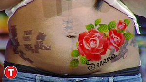 Cum a ales o vedeta de la noi sa isi mascheze urmele lasate pe abdomen dupa ce a fost mutilata la un salon de infrumusetare!
