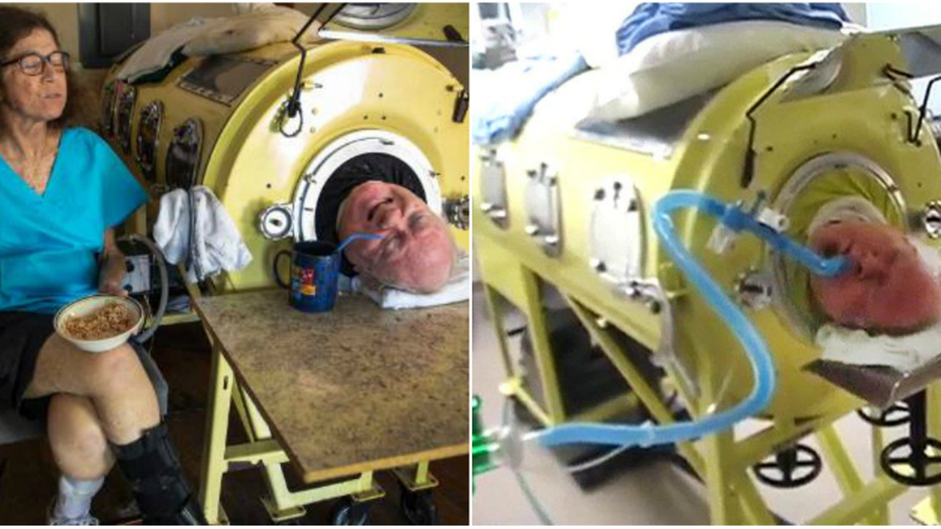 Barbatul sufera de o boala rara si sta de 60 de ani captiv intr-o masinarie uriasa! E socant ce s-ar intampla cu el daca ar incerca sa iasa. DE CE nu il pot ajuta medicii VIDEO