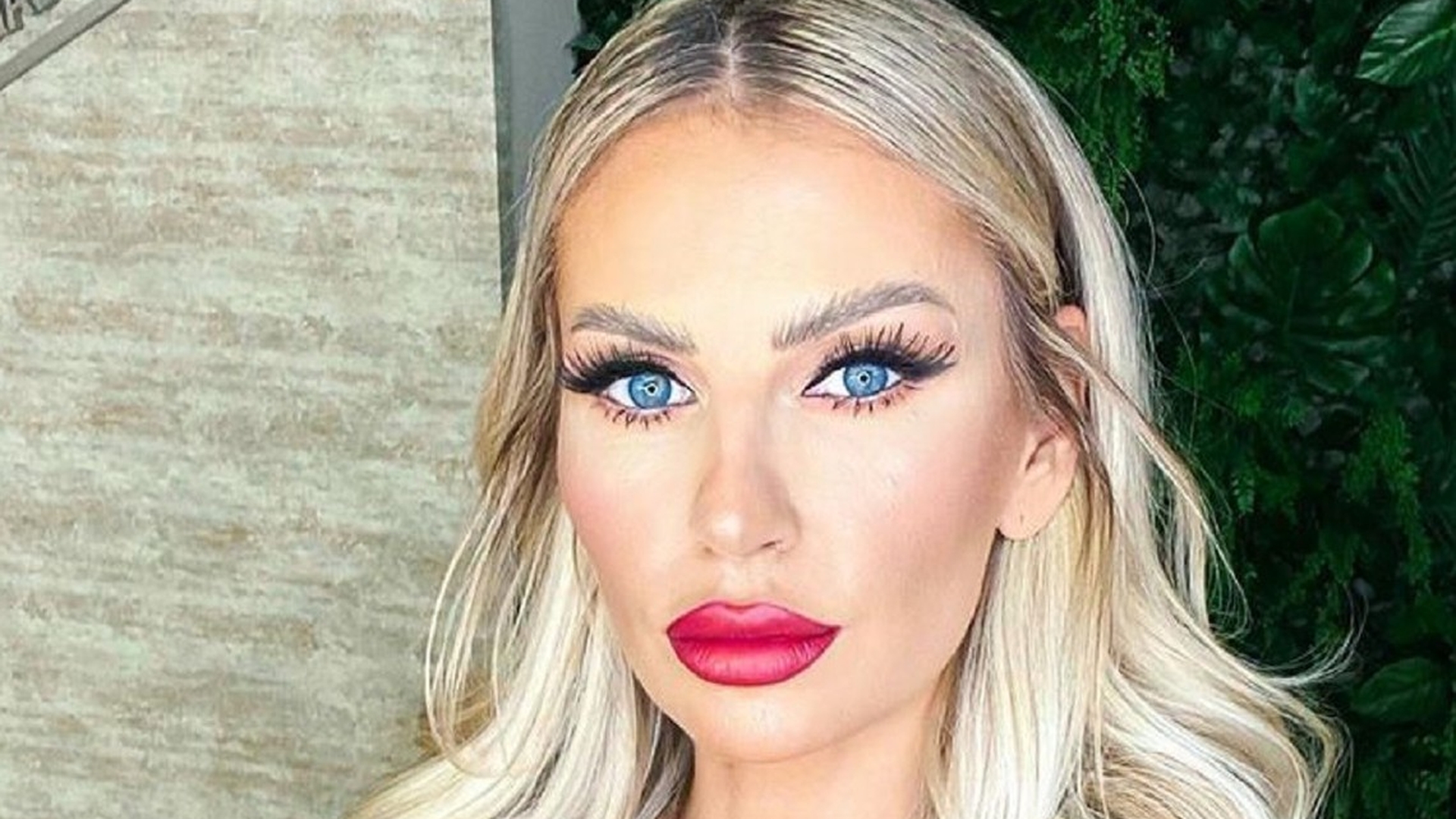 Andreea Bănică, operată de urgență. Cu ce problemă de sănătate se confruntă artista „Nu mai poate fi amânată”