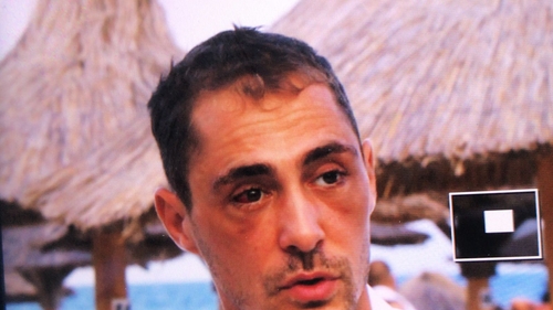 De ce a apărut Vladimir Drăghia cu ochii vineți la propria nuntă. “Există un singur adevăr!”