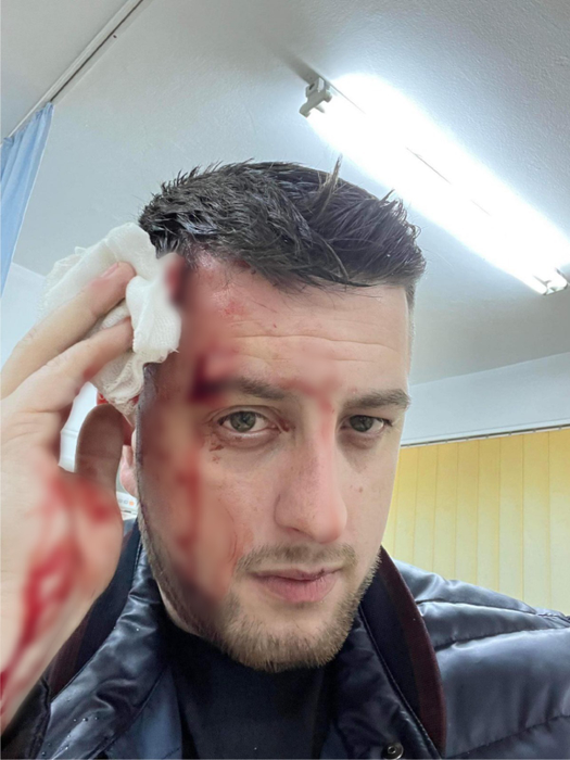 Nelu Popa, saxofonistul lui Carmen de la Sălciua, a fost lovit cu paharul în cap, într-un local, și a ajuns la spital (Foto: CANCAN.RO)