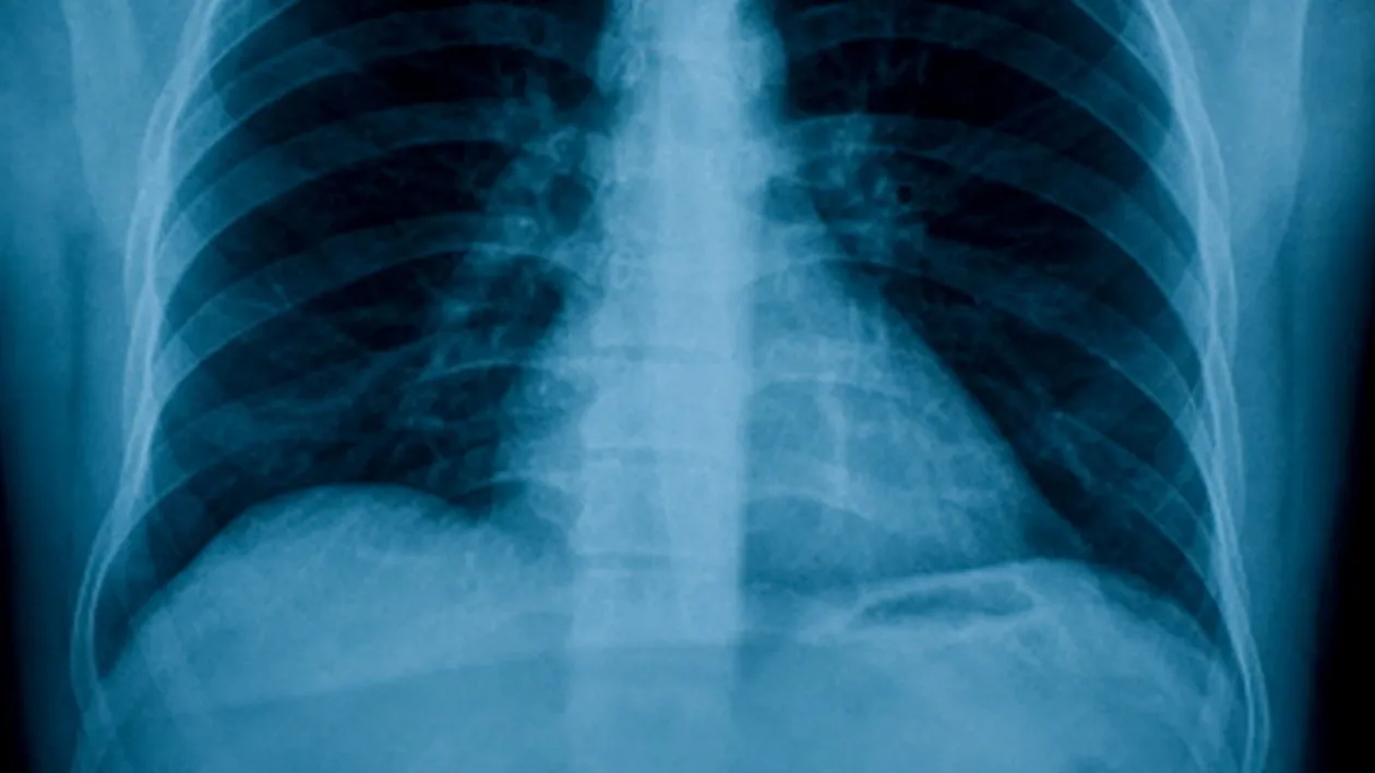 Reactia scandaloasa a medicilor romani dupa ce au ramas socati in fata acestei radiografii. Ce au vazut in ea