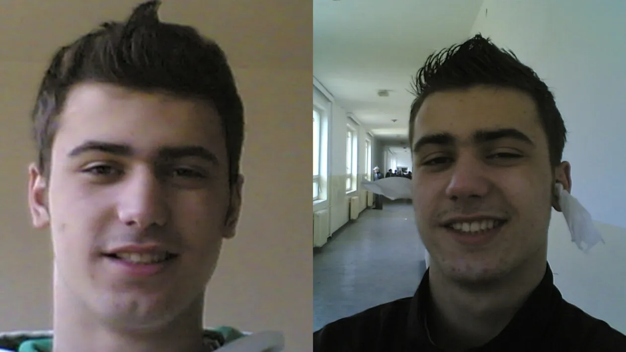 Îl recunoști? Sportivul celebru din România tocmai și-a făcut implant de păr