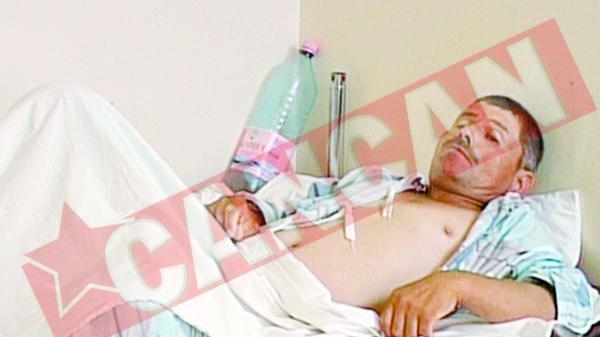 Si-a tratat testiculele cu praf pentru porci