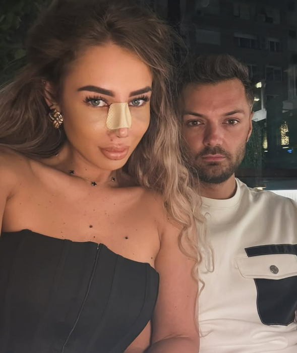 Maria Avram, de nerecunoscut după rinoplastie! Cum arată acum concurenta Insula iubirii 2025