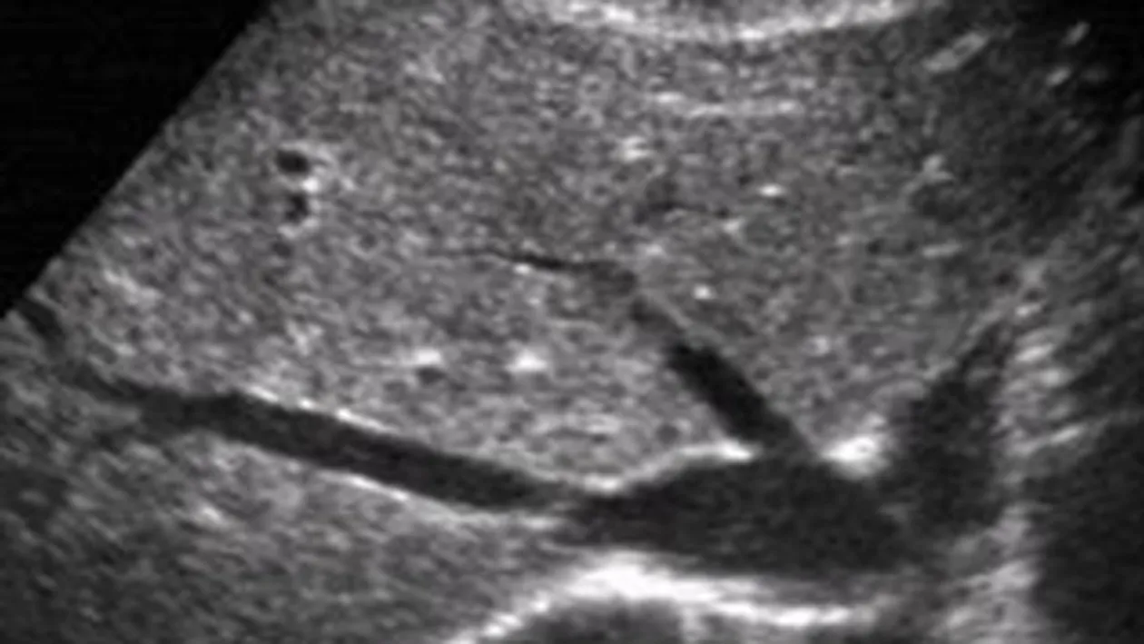 Medicii au ramas socati dupa ce au descoperit ce se afla in burta acestei femei: Nimeni nu-i dadea nicio sansa