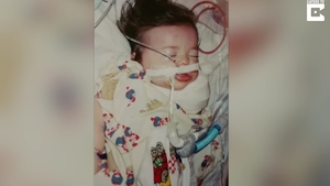 Fetita cu „tentacule”! Medicii i-au spus femeii sa faca avort, dar ea nu a vrut sa auda de asta! Cum arata micuta pe care a adus-o pe lume?
