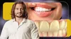 Cum își pot albi românii dinții în mod natural? Ce spune Dr. Cezar despre smalț, dentină și rolul unei vitamine importante