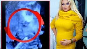 Sânziana Buruiană, însărcinată din nou?! A repostat poza cu ecografia: "Botoasa mică din burtică"