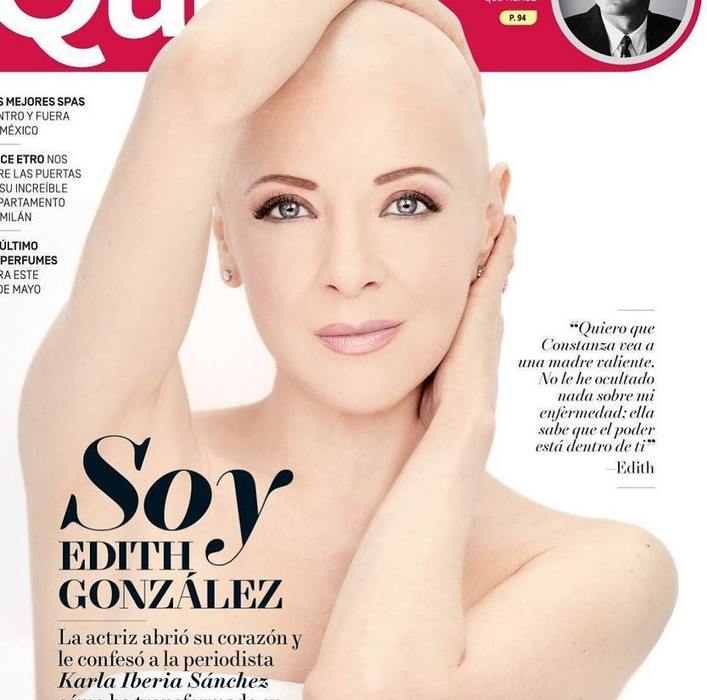 Celebra EDITH GONZALES îşi revine miraculos în lupta cu cancerul! După ce a renunţat la peruci, actriţei a început să îi crească din nou părul