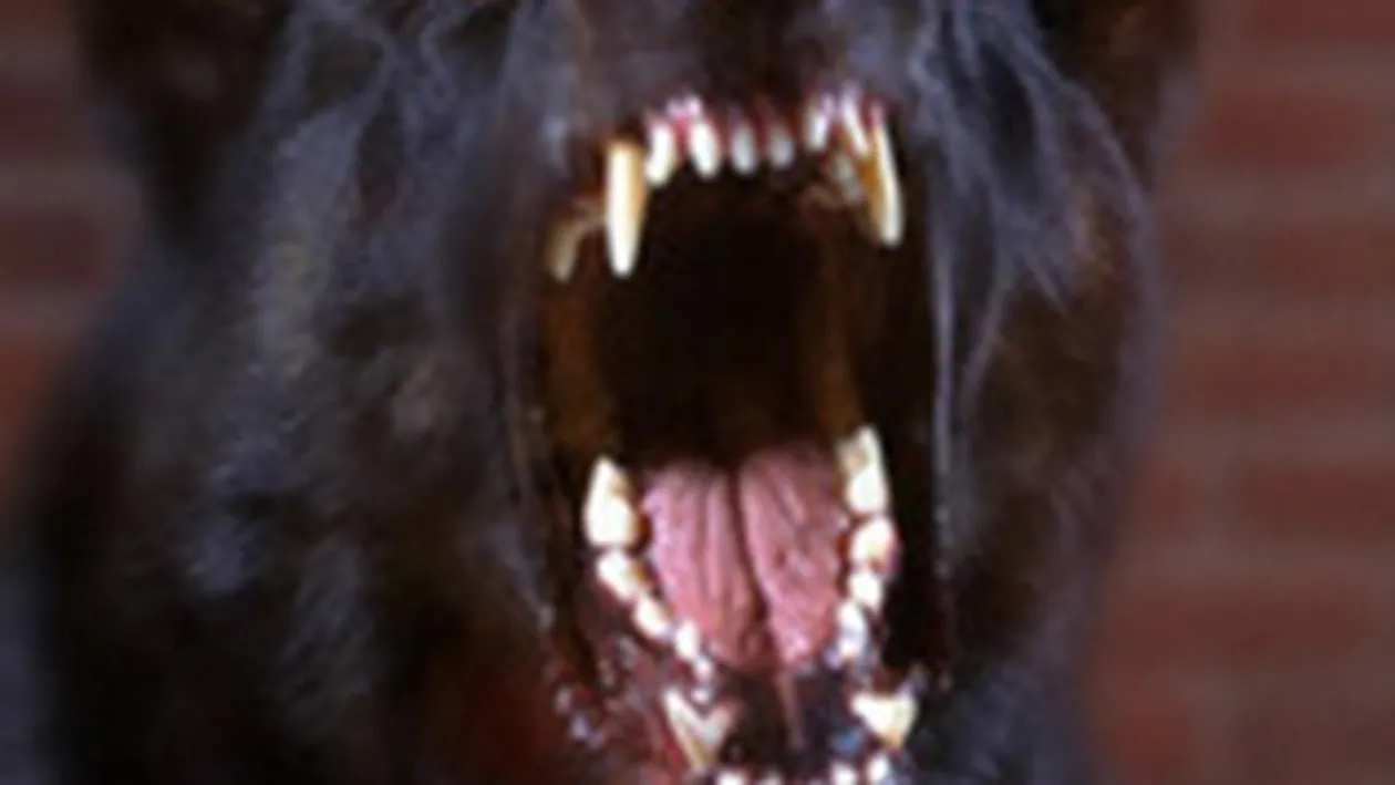 O fetita in varsta de cinci ani a fost muscata de fata de cainele unor vecini