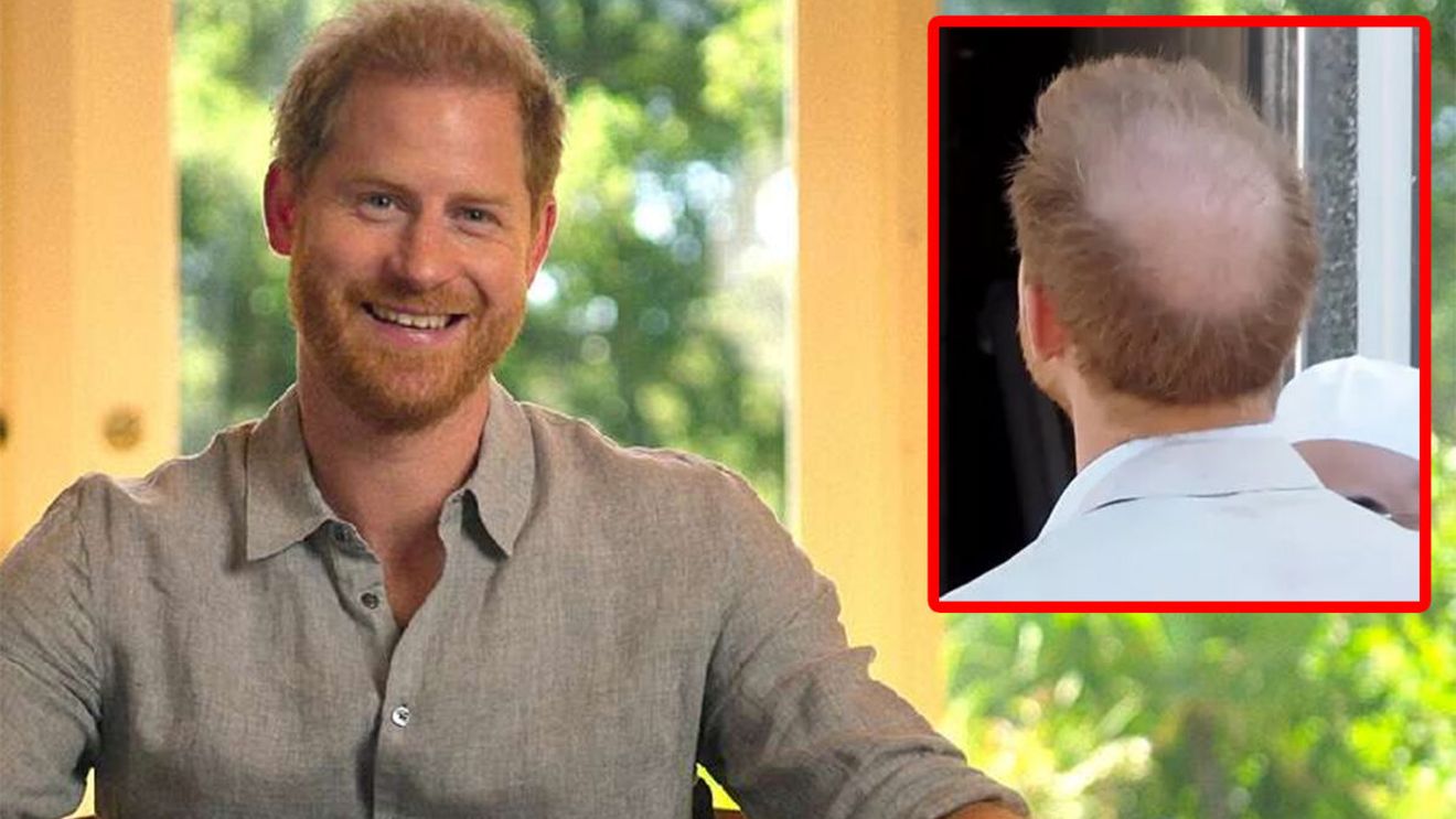 S-a aflat adevăratul motiv pentru care Prințul Harry chelește. Are legătură cu Meghan Markle