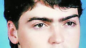 Un american a suferit cel mai complex transplant facial. Asa arata dupa ce a fost impuscat in fata