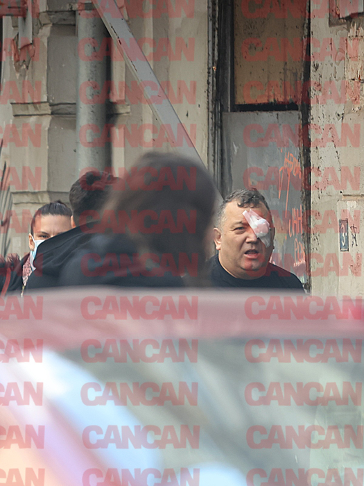 Nuredin Beinur, bandajat la ochi după ce a fost împușcat (Foto: CANCAN.RO)