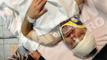 Batut mar in plina strada. Atacat de trei malaci, Andrei Tirdea a ajuns la spital aproape inconstient. Are capul spart in 3 locuri
