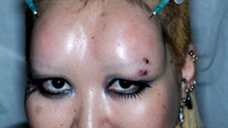 Tatuajele si piercingurile sunt depasite! Noua moda in materie de mutilare fizica este oripilanta: limbi despicate, dinti de vampiri si frunte monstruoasa!