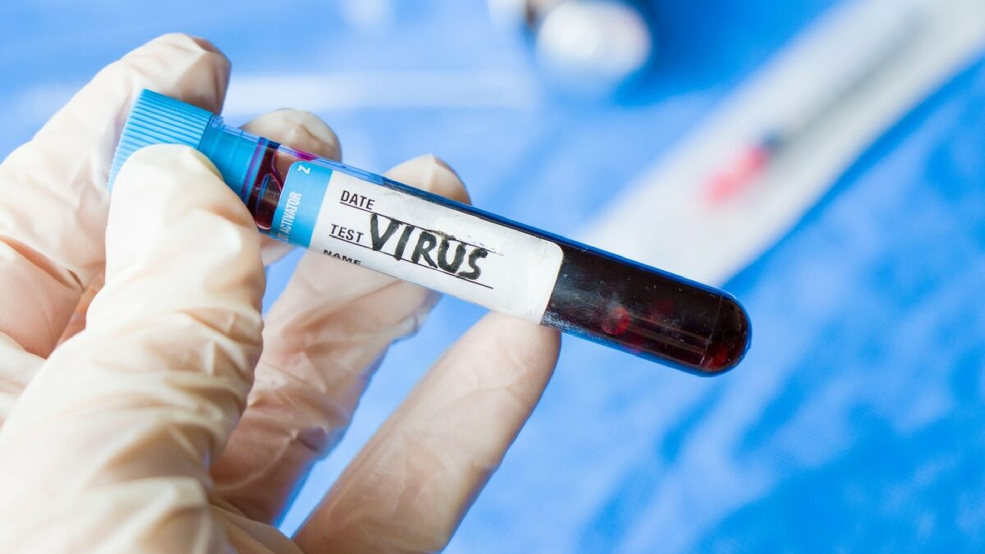 Alertă medicală în România! A fost confirmat un nou caz de virus Chikungunya