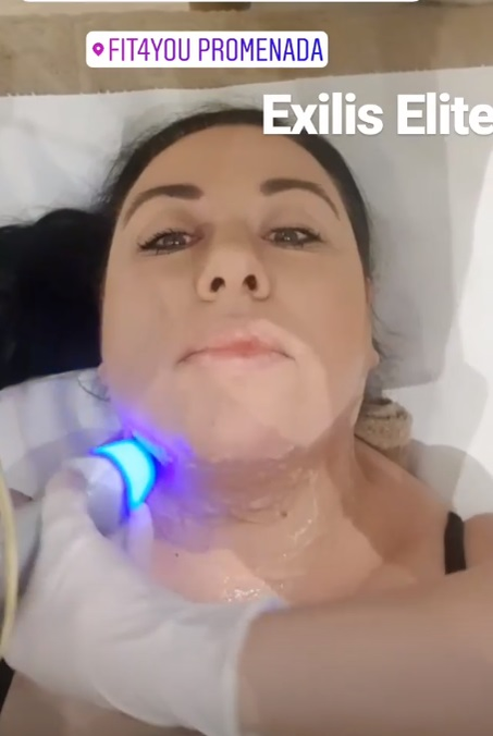 Oana Roman “și-a sculptat” fața! S-a filmat în timpul procedurii estetice
