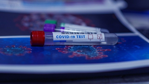 Teste diagnostic și anticorpi COVID-19. Cum afli dacă ești infectat sau dacă ai avut infecția în trecut 