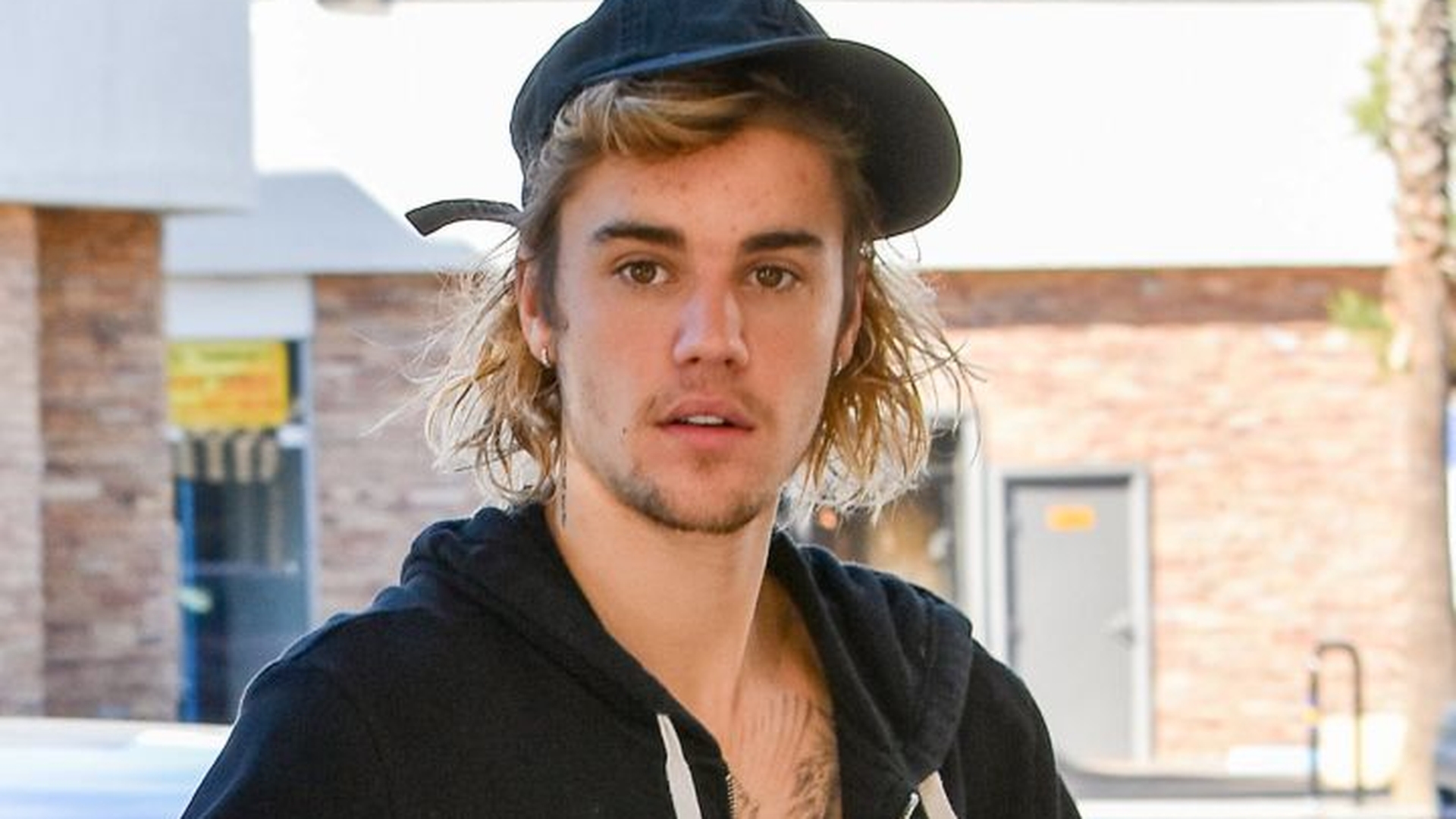 Fanii lui Justin Bieber sunt în stare de șoc! Artistul a anunțat de ce boală suferă