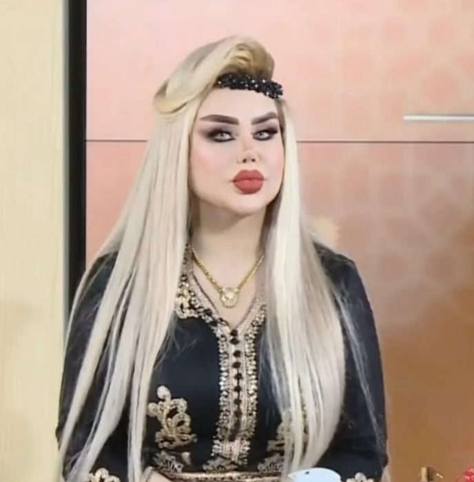 Dalia a vrut să arate ca păpușa Barbie, dar rezultatul i-a șocat pe apropiați. După 43 de operații, tânăra de 30 de ani este asemănată cu un zombi