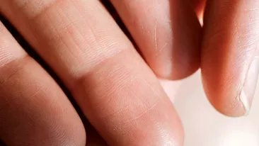 Știați că gemenii identici nu au aceleași amprente? Află aici cauzele