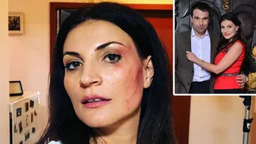 Mi-am luat-o Ioana Ginghină, cu fața tumefiată la doar câteva zile după ce s-a spus că divorțează de Alexandru Papadopol