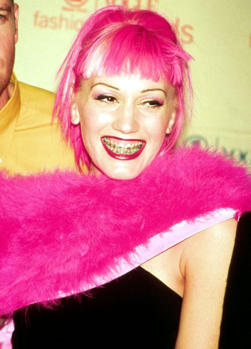 Gwen stefani a purtat aparat dentar