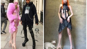 ‘Materie Fecala’, cuplul de pe Instagram care s-a viralizat imediat! Tinerii care arata ca extraterestrii sunt uluitori. De ce talpile ei arata ASA