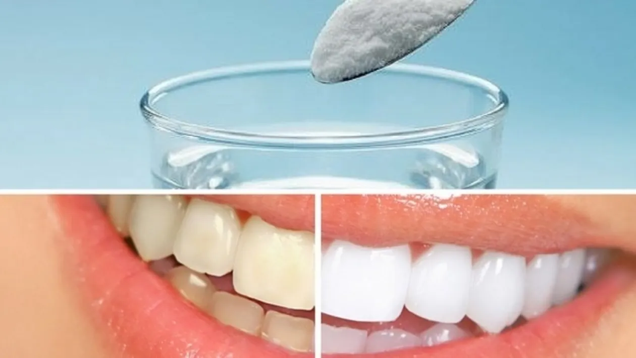 Ai mult tartru pe dinti? Uite cum poti scapa de el acasa, cu cateva ingrediente ieftine si o scobitoare