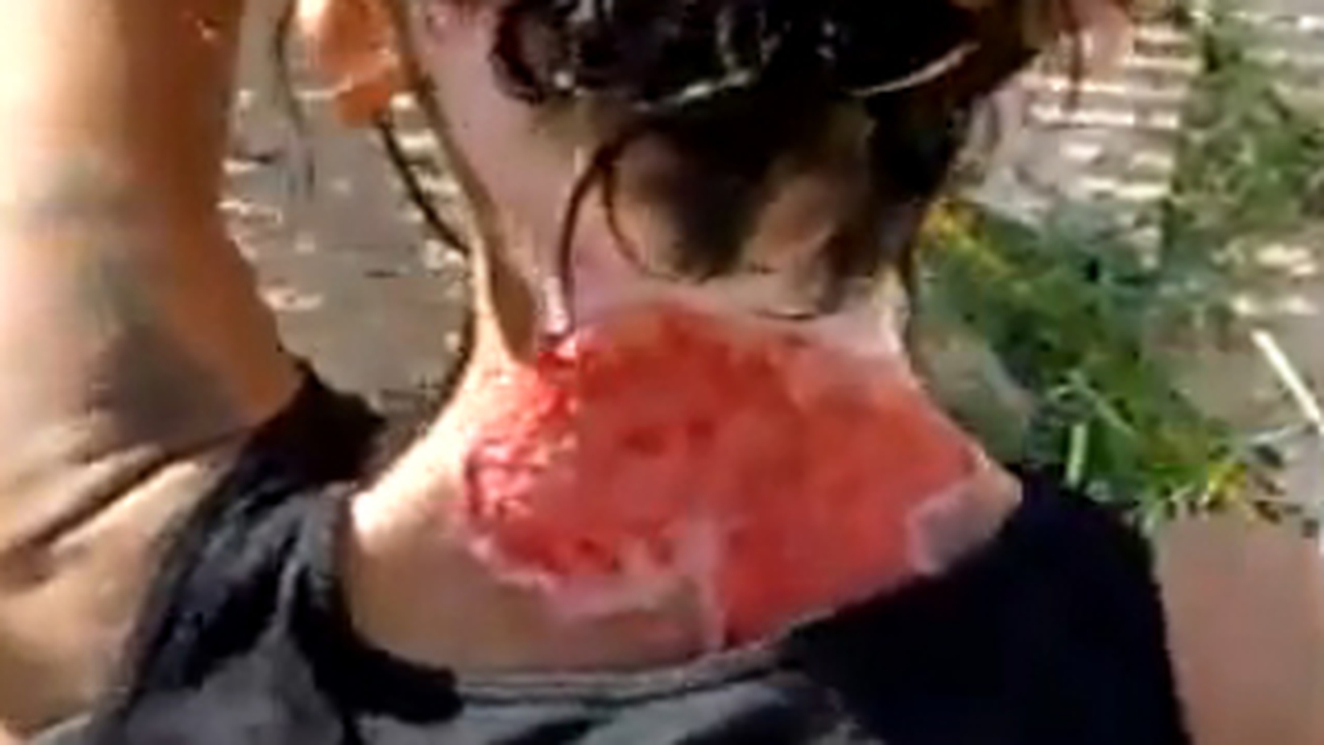 VIDEO Uite cum arata o drogata care s-a scarpinat pana la sange, dar spune ca a fost injunghiata