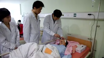 FOTO SOCANT La 20 de ani, desfigurata de o tumoare. VEZI AICI imagini cu Fata Avatar!