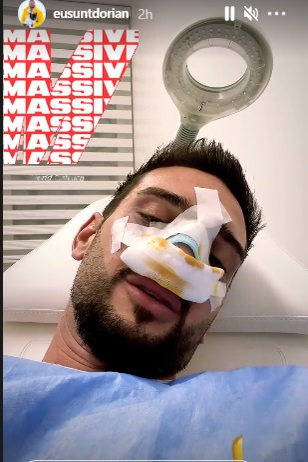 A zis că nu-și va opera nasul niciodată, dar s-a răzgândit! Cum arată Dorian „Hâtz” Popa, după ce și-a făcut rinoplastie