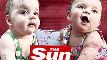 VEZI AICI Cum arata gemenele de noua luni muscate de vulpe