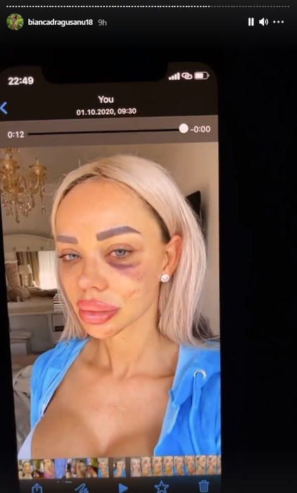 Bianca Drăgușanu a arătat din greșeală înregistrarea cutremurătoare în care este leșinată lângă pat: “Am trăit în casă cu un om care mă filma non stop! Nu ți se pare că ăsta e șantaj?!”