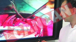 A operat pe cord un bebelus de 660 de grame