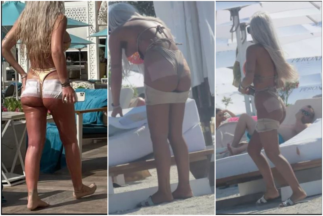 Loredana Chivu, cu fesele bandajate la plajă (Foto: CANCAN.RO)