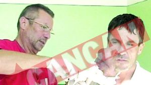 I-au extirpat o tumora de 2,430 kg